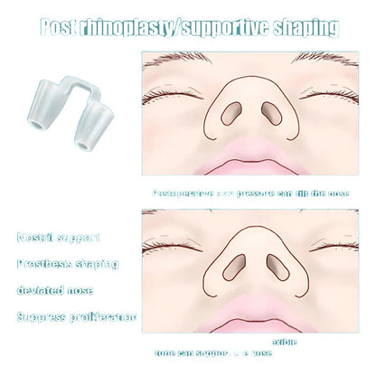 Retenedor Nasal Silicon Rinoplastia Medidas A Elegir Blanco 6b Mediano