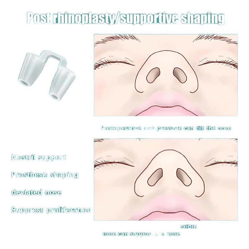Retenedor Nasal Silicon Rinoplastia Medidas A Elegir Blanco 7c Grande