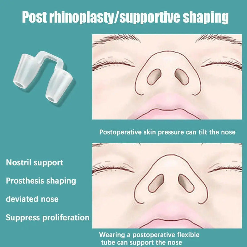 Retenedor Nasal Silicon Rinoplastia Medidas A Elegir Blanco 5a Chico