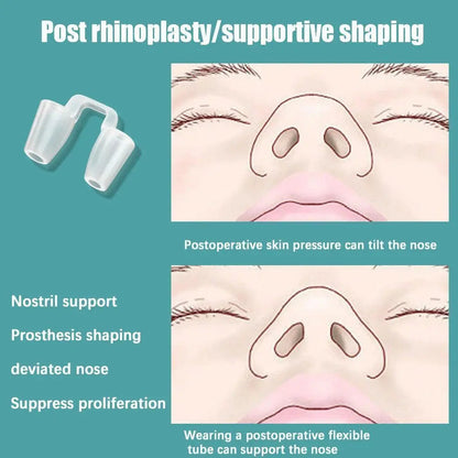 Retenedor Nasal Silicon Rinoplastia Medidas A Elegir Blanco 5a Chico